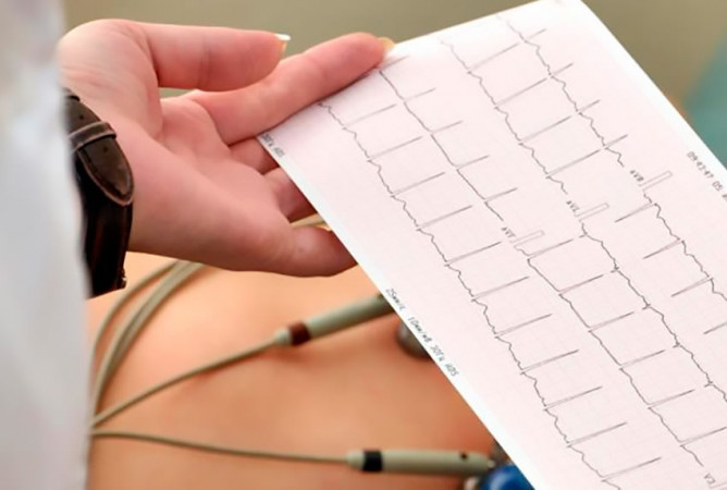 Electrocardiograma en Guayaquil para evaluar la actividad eléctrica del corazón