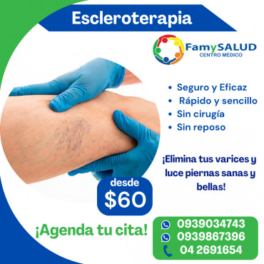 La escleroterapia es un tratamiento seguro y eficaz para eliminarlas sin cirugía.