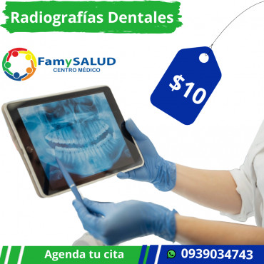 Las radiografías dentales no solo son una herramienta de diagnóstico, ¡son una parte esencial de tu cuidado dental ¿Por qué son importantes? Nos permiten detectar problemas que no se ven a simple vista, como: • Caries entre dientes • Infecciones en e