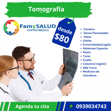 La tomografía es una herramienta clave para un diagnóstico rápido y preciso.