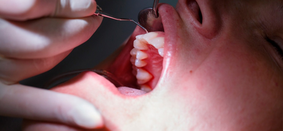 Periodoncia