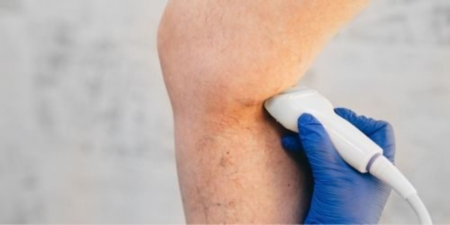 Ecografía Doppler Arterial de Extremidades